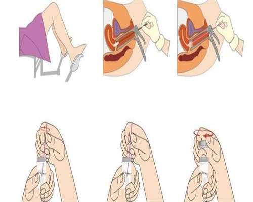 孕期囊肿多大影响胎儿