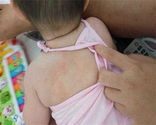 备孕**怎么做(饮食和*活习惯要注意)