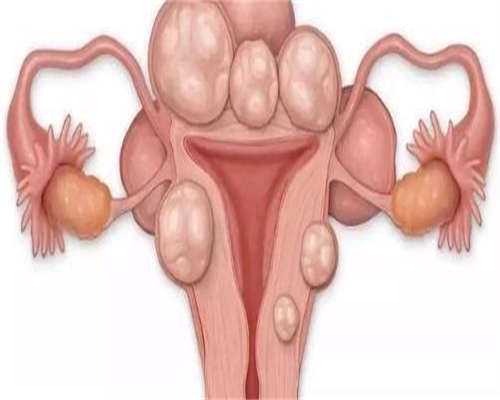 怀孕第一次做什么b超