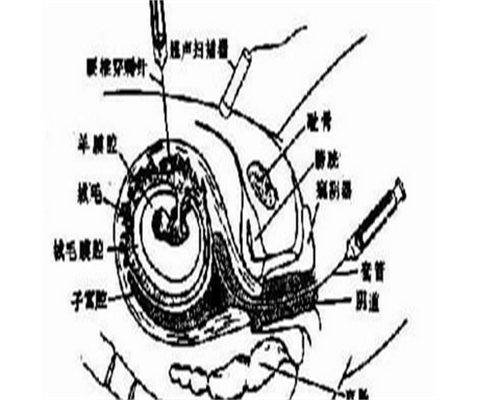 黄体酮低泌乳素高，吃什么药才能改善？要做人工授精吗？