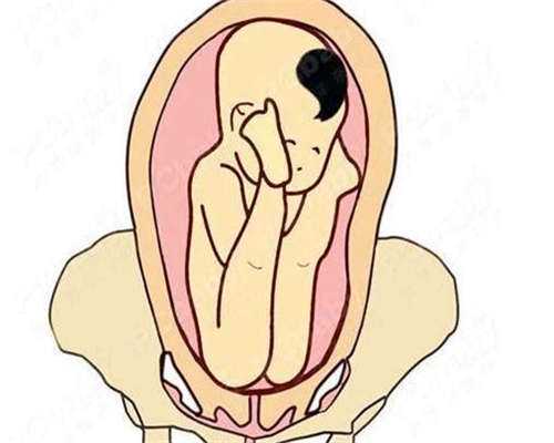 代生男孩技术-促进卵泡生长方法是什么