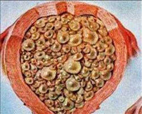 试管婴儿一二三代的区别及成功率？试管婴儿1代2代3代价格？