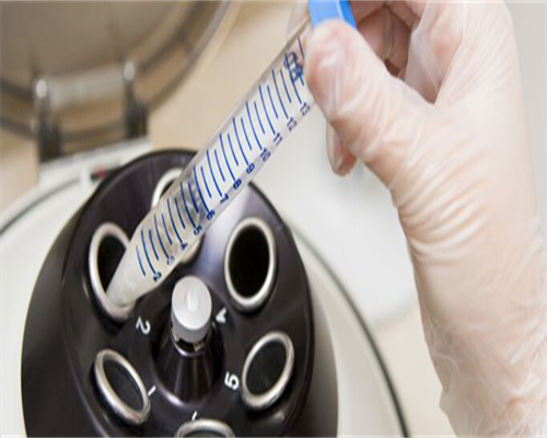 非月经期阴道出血，是得阴道癌了吗？