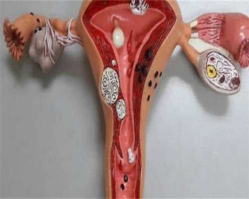 试管代生网-月经量少黑能做试管吗？月经量少发黑能做试管婴儿吗？