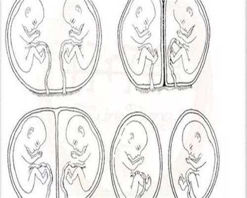 代生孩子流程-排卵后剩下的卵泡是瘪的吗?