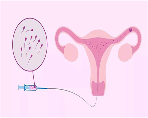 供卵代孕机构-试管较好的山东第三代正规医院排名前十