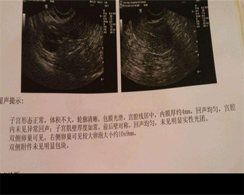 正规试管代怀-济南红十字医院试管费用多少？哪些因素会影响试管婴