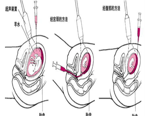 重庆西南医院试管三代技术完善吗？