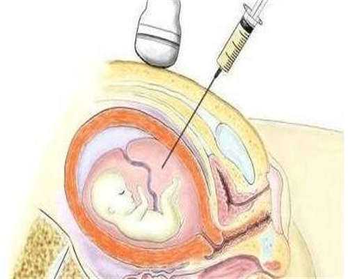 淄博三代试管移植女宝宝
