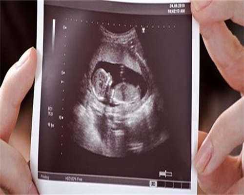 试管婴儿前，女性需要做哪些检查？